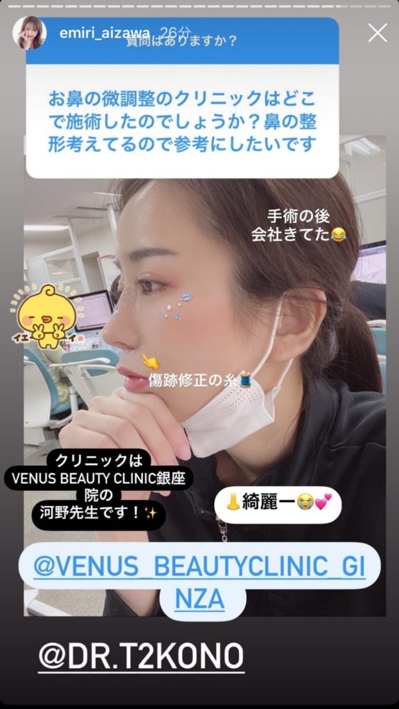 エミリアウィズが名古屋高島屋で期間限定ショップ開催 愛沢えみりcの整形修正が綺麗すぎると話題に Ms2300blog