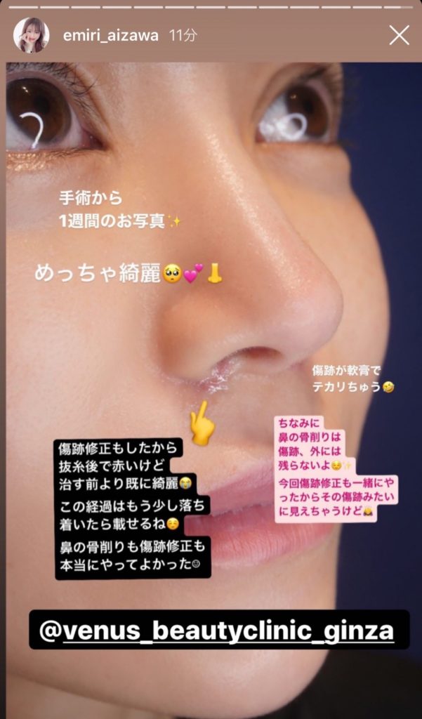 エミリアウィズが名古屋高島屋で期間限定ショップ開催 愛沢えみりcの整形修正が綺麗すぎると話題に Ms2300blog