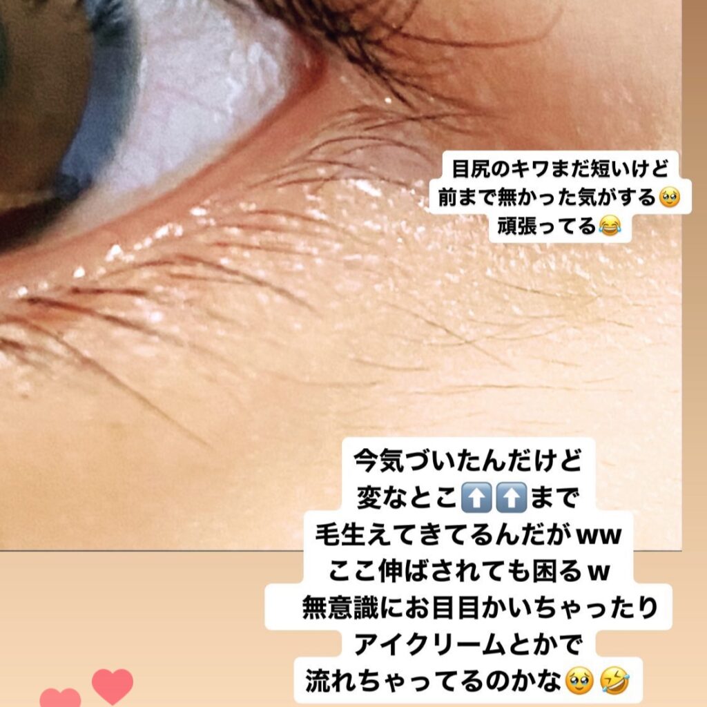 エマーキット まつ毛美容液 色素沈着したら まつ毛美容液EMAKED エマーキット は効果が強い